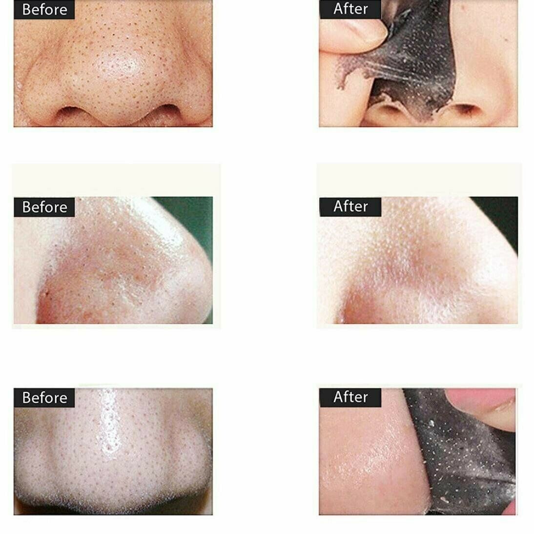 Facial Cleansing Charcoal Mask Blackhead Remover Purifying Acne Peel-off Mask Shills Does not Apply - фотография #4