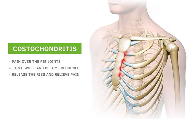 - Upper Back and Headache Pain Relief - Treatment for Costochondritis and Tietze Does not apply - фотография #4