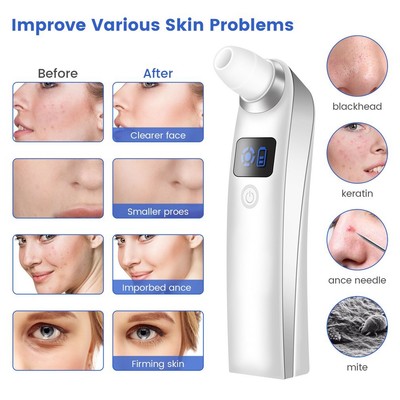 New Blackhead Remover Wireless Camera Taking App Intelligent Control Skin pP Unbranded Does Not Apply - фотография #2