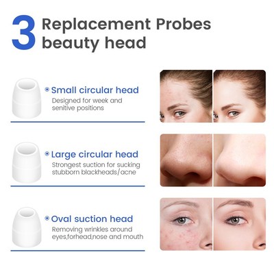 New Blackhead Remover Wireless Camera Taking App Intelligent Control Skin pP Unbranded Does Not Apply - фотография #9