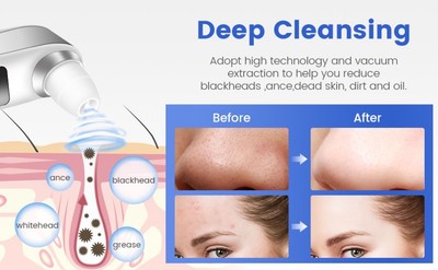 New Blackhead Remover Wireless Camera Taking App Intelligent Control Skin pP Unbranded Does Not Apply - фотография #8